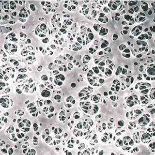Filtres à membrane Acétate Cellulose ENROBES - NON STERILES - UNIS